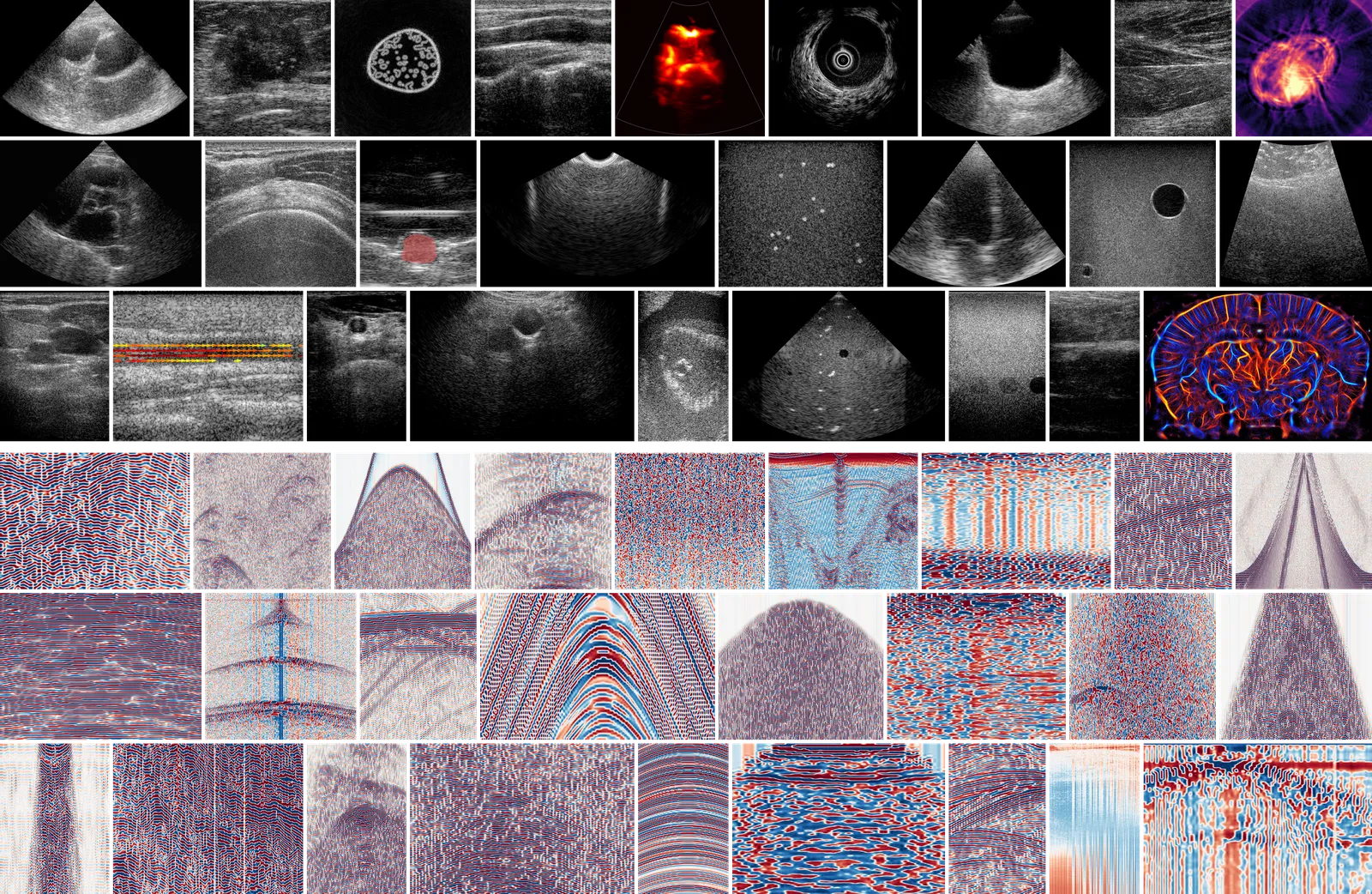 Collage of ultrasound acquisitions from the OpenH-RF dataset